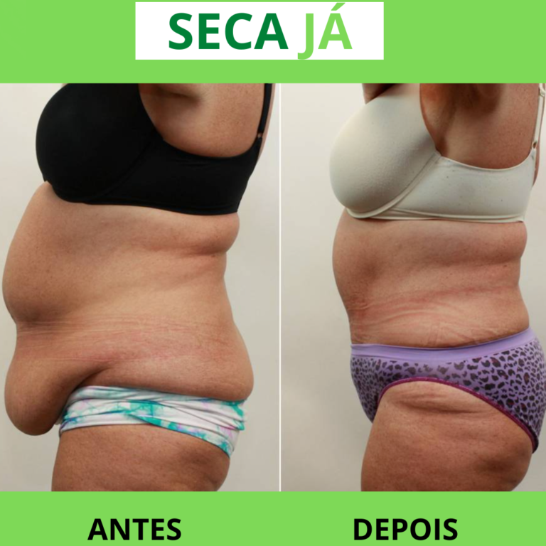 SECA-JA-2-768x768-1.png